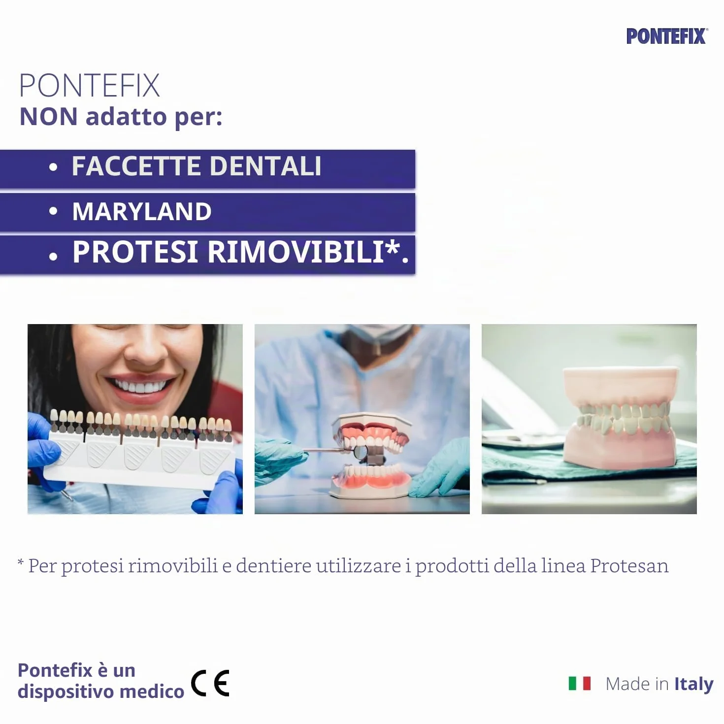 Cemento Dentale per Fissare Ponti, Capsule Dentali e Denti Pivotanti